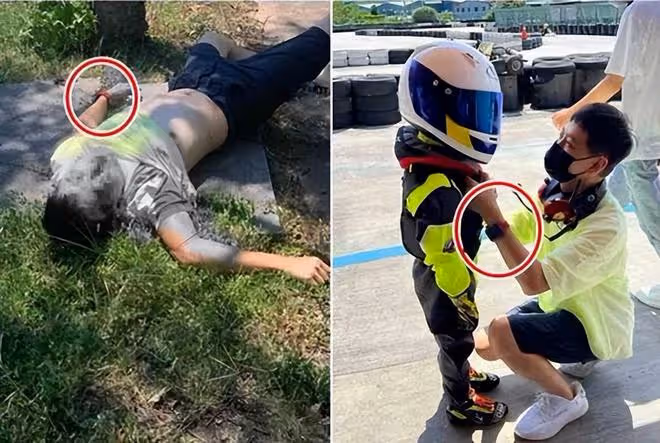 林志穎面部修復情況曝光:小小縫了一下,已沒問題