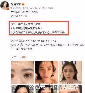 網紅灣灣整容前照片被扒,整前平平無奇,整後被指神似李多海