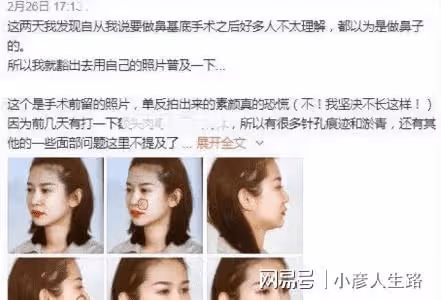 網紅灣灣整容前照片被扒,整前平平無奇,整後被指神似李多海