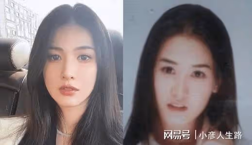 網紅灣灣整容前照片被扒,整前平平無奇,整後被指神似李多海
