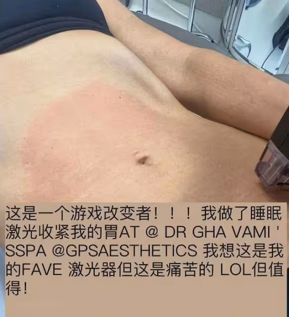 42歲卡戴珊瘦身大變樣 深V連體衣出街太性感