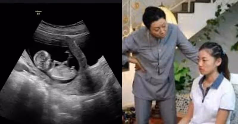 全家都盼生女兒！產檢出爐是兒子　人妻無奈「婆婆又買轉性藥」最後真的流掉了