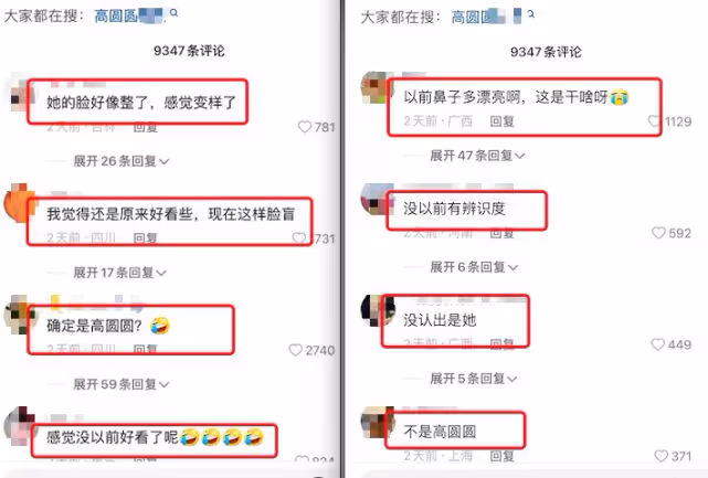高圓圓出席活動變化好大，臉部僵硬額頭大，網友直呼認不出！