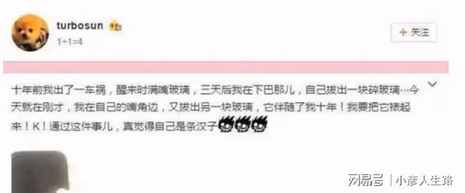殷桃的唇上痣,孫儷的痦子,千璽的坑,明星的特點你認得出嗎?