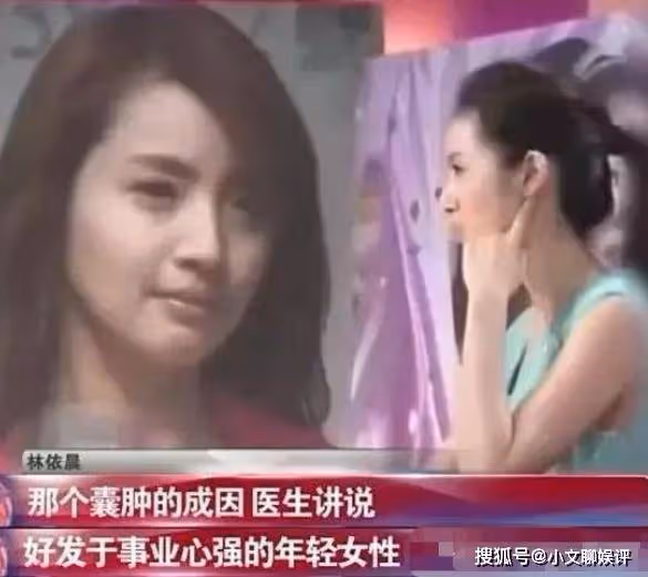 她曾是「小龍女」第一人選,卻因太紅不想演,結果古裝劇接連翻車