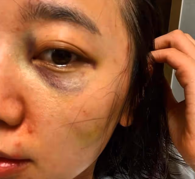 徐莎朗被曝婚內出軌!多次酒店開房並吸食大麻,曾控訴老公家暴