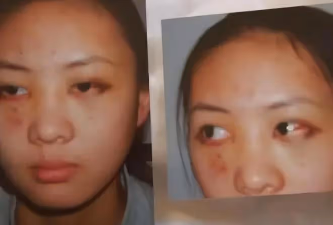 童瑤素顏喝酒腫到快認不出,拿電子菸與男性調笑,富豪老公疑在旁