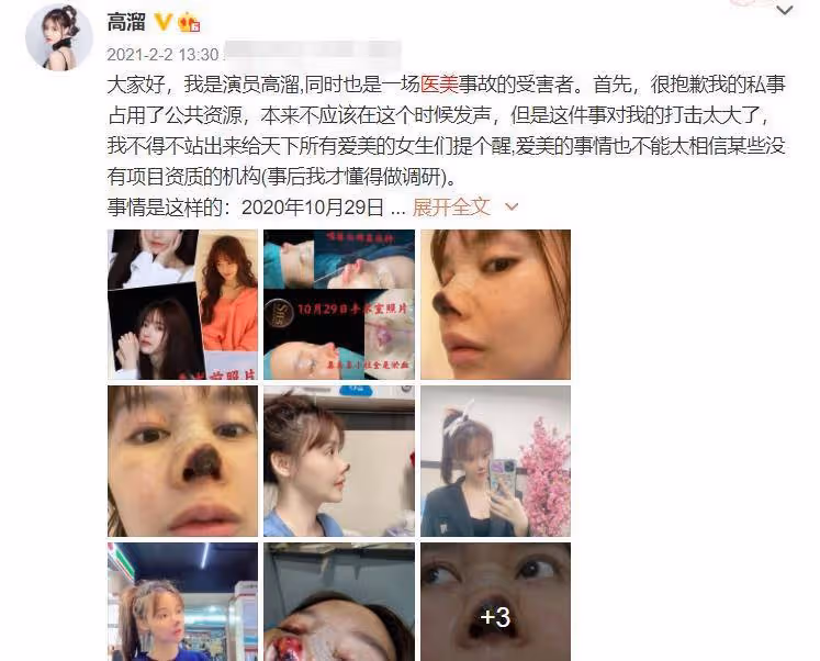 誰說動臉毀顏值?《香蜜》撲哧君,才是明星整容的正確打開方式