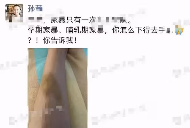 網曝演員孫茜遭家暴!疑孕期被打小腿青紫,曾與富豪老公頻秀恩愛