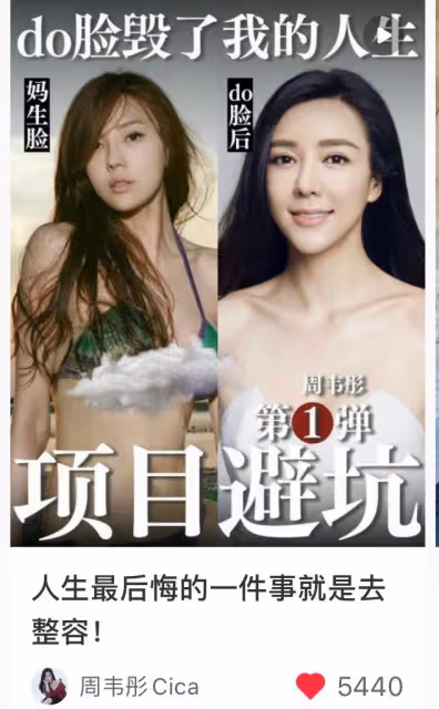 40歲女星承認整容!五官全動整完後臉腫似豬頭,自曝後遺症太嚴重