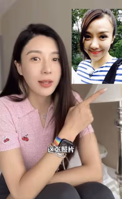 40歲女星承認整容!五官全動整完後臉腫似豬頭,自曝後遺症太嚴重