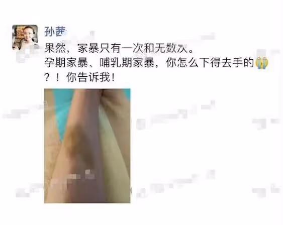 拿朋友的家暴圖來冒充自己,還害老公被全網罵,孫茜是蠢還是壞?