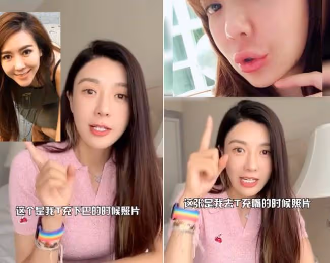 女星周韋彤自曝曾全臉整容 下巴打針變成蛇精臉