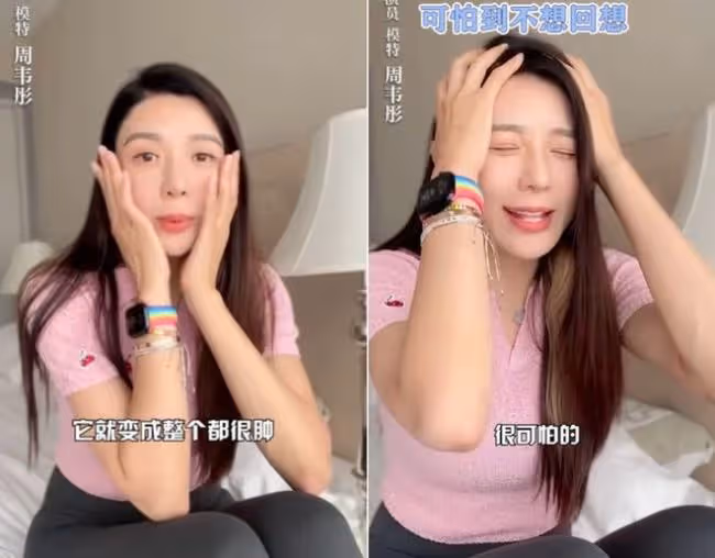 女星周韋彤自曝曾全臉整容 下巴打針變成蛇精臉