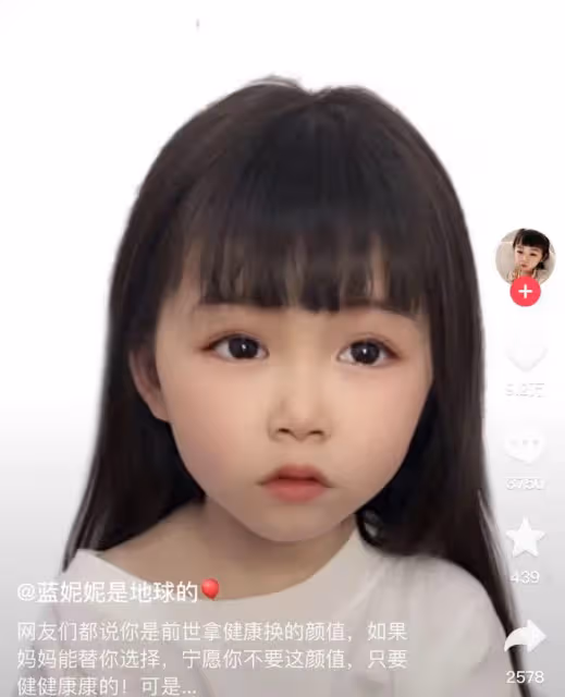 百萬網紅決定生二胎引爭議!女兒患罕見基因病,二孩大機率也患病