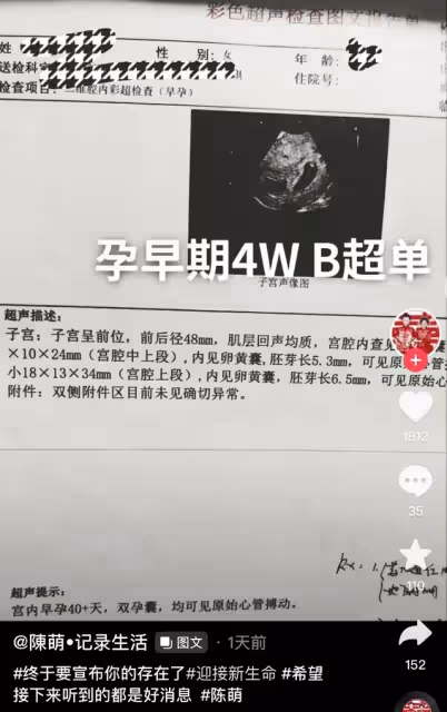 大衣哥兒媳懷雙胞胎40天!曬B超照打臉陳亞男,此前辭職疑為養胎
