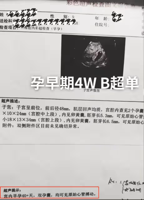 大衣哥兒媳懷雙胞胎40天!曬B超照打臉陳亞男,此前辭職疑為養胎