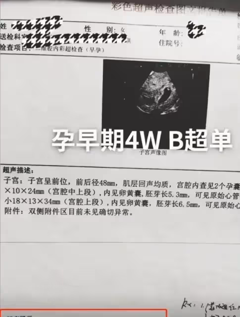 大衣哥兒媳陳夢功不可沒,B超顯示懷上雙胞胎,朱曉薇升級當爹了