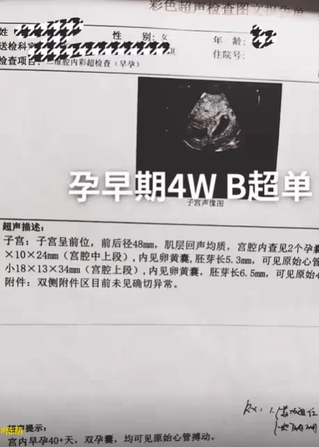 恭喜,大衣哥兒媳懷雙胞胎,22歲小偉已經是兩個孩子的爸爸了!