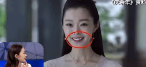 宋軼整牙前後的變化有多大?剛出場就被叫「齙牙珍」,連親媽也嫌