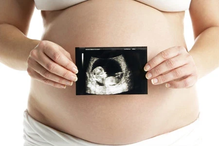 懷孕6個月的孕婦被迫引產，看到孩子的一瞬間，婆婆大喊：這就是報應呀