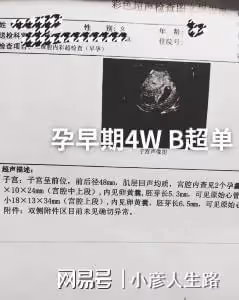 恭喜!陳萌懷雙胞胎後,網傳朱小偉要競選村長,大衣哥疑出資500W