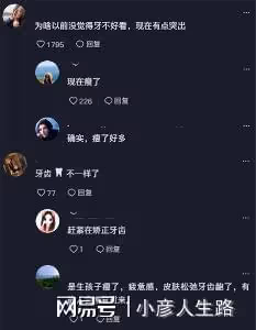 還記得「不倒翁小姐姐」?婚前很有靈性,婚後眼裡沒光,牙變突出