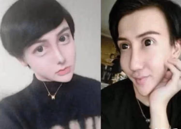 還記得整容失敗成「蛇精臉」的劉梓晨嗎？如今成功逆襲，顏值不輸楊穎