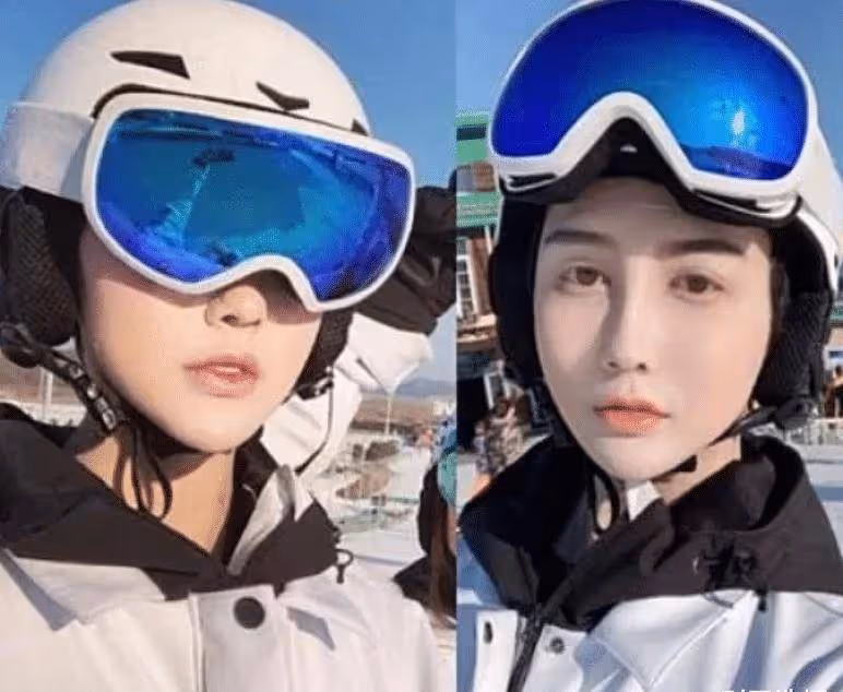 還記得整容失敗成「蛇精臉」的劉梓晨嗎？如今成功逆襲，顏值不輸楊穎