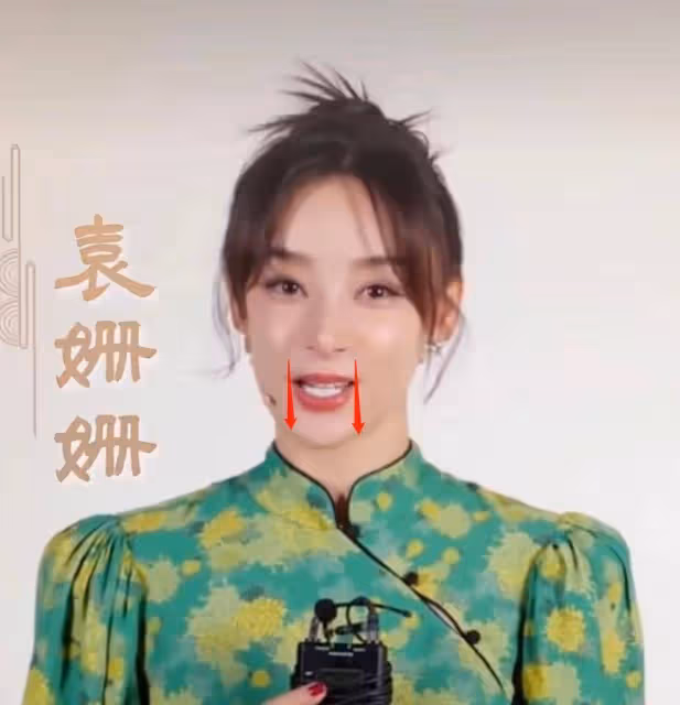 35歲袁姍姍近照曝光!說話的時候,她的嘴巴明顯是歪的,蘋果肌也很臃腫,被質