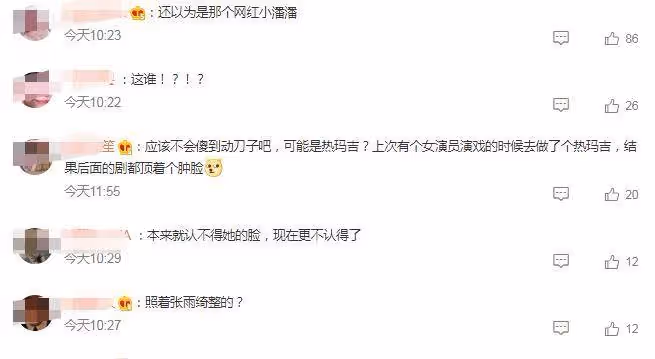 35歲袁姍姍近照曝光！說話的時候，她的嘴巴明顯是歪的，蘋果肌也很臃腫，被質