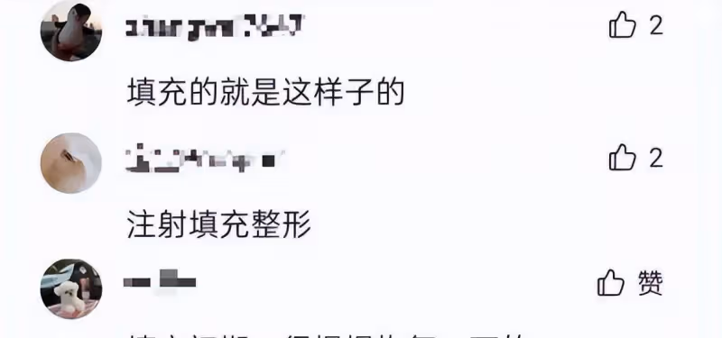 滿臉玻尿酸,笑比哭更難看,這10顆滿臉的星星,一個都說不出口