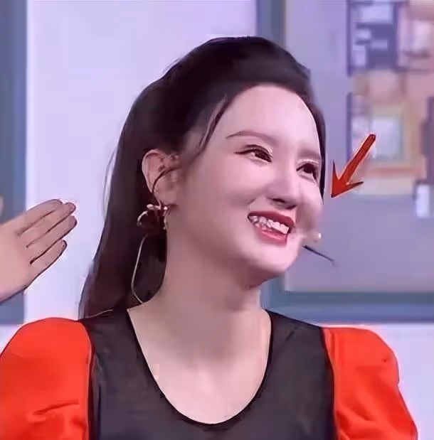 滿臉玻尿酸,笑比哭更難看,這10顆滿臉的星星,一個都說不出口