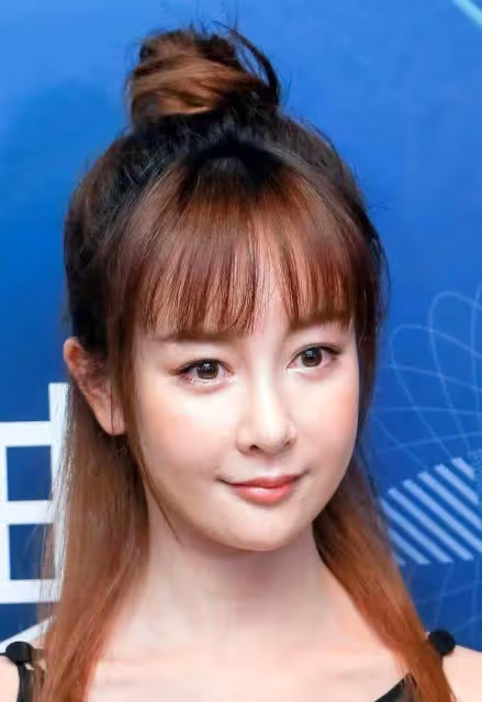 滿臉玻尿酸,笑比哭更難看,這10顆滿臉的星星,一個都說不出口