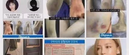 某28歲女星家中自殺，男友曝光私密視頻，父母卻在爭搶五十億遺產
