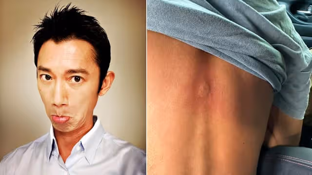 吳慷仁拍戲遭虎頭蜂螫咬