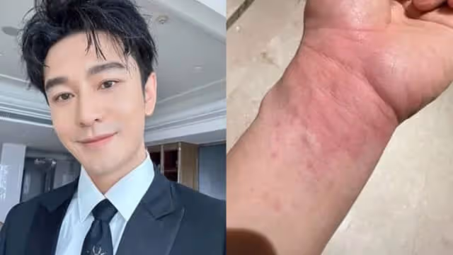 黃曉明深夜曬美食　半小時後被送醫院