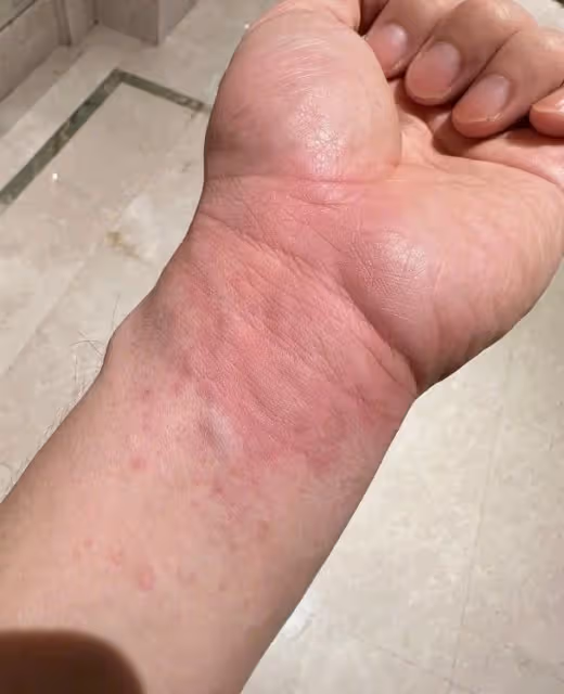 深夜曬家鄉烤肉串隔天腸胃炎進院　黃曉明：美食不愛我