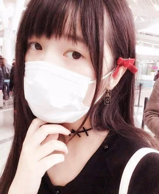 萬萬沒想到，22歲的徐嬌也跑去整容了，網友：一副好五官毀了