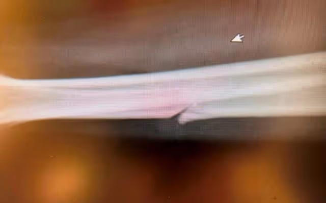 好慘!香港男星遇襲重創後自認陰影大,每晚得靠大劑量安眠藥入睡