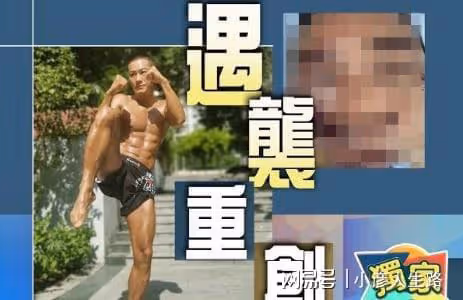 港星黃竣鋒深圳被砍傷後續:臉傷嚴重永久留疤,暫未獲得任何賠償