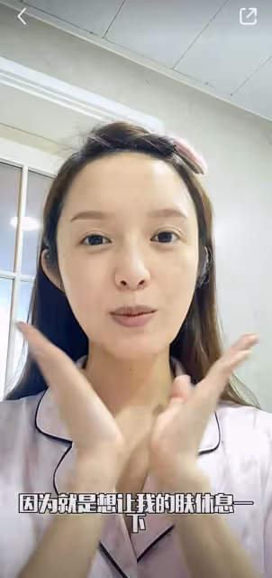 TVB甜美女神曬素顏照!五官精緻黑眼圈突出,曾深陷整容傳聞