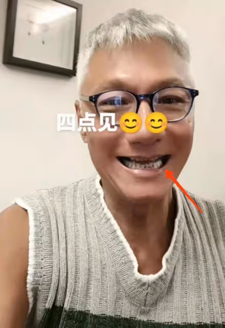 曝「香港第一美男」林俊賢近況,滿頭白髮牙齒稀疏,模樣蒼老難辨