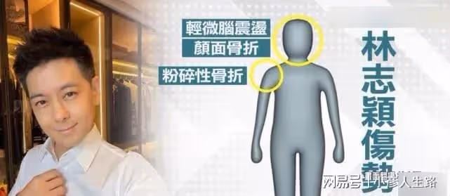 林志穎講述車禍關鍵細節：確定有系安全帶！事故原因成謎