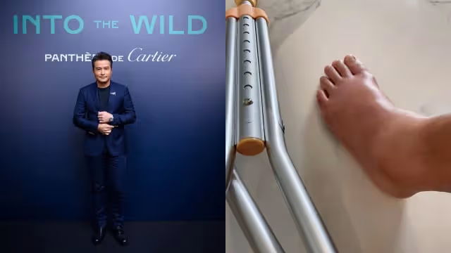 李銘順左腳「腫成豬腿」　將缺席金鐘獎頒獎典禮
