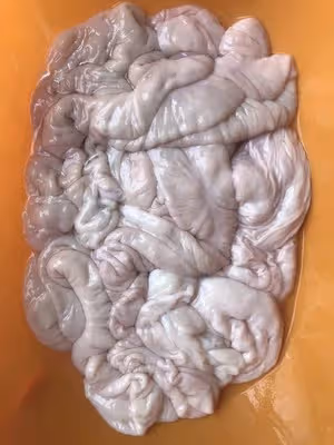 如何處理生肥腸