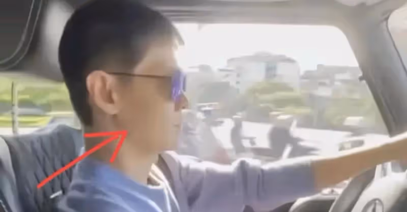 車禍三個月，林志穎曬開奔馳車照，身材消瘦酒窩明顯，臉部無塌陷