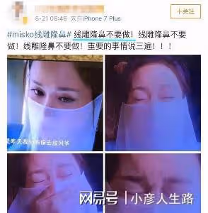 影視圈「假鼻子」大賞：誰堪稱點睛之筆，誰越整越「奇怪」？