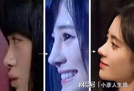 影視圈「假鼻子」大賞：誰堪稱點睛之筆，誰越整越「奇怪」？