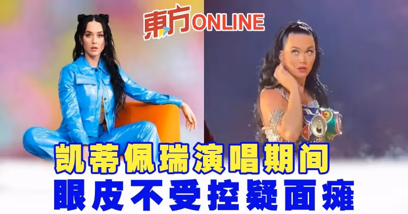 凱蒂佩瑞演唱期間　眼皮不受控疑面癱？！